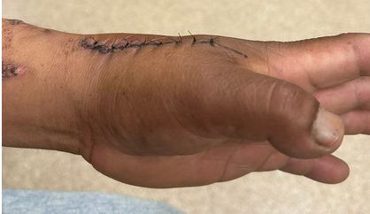 EM weekly case challenge:
Suture Removal
erpocketbooks.com/p1/