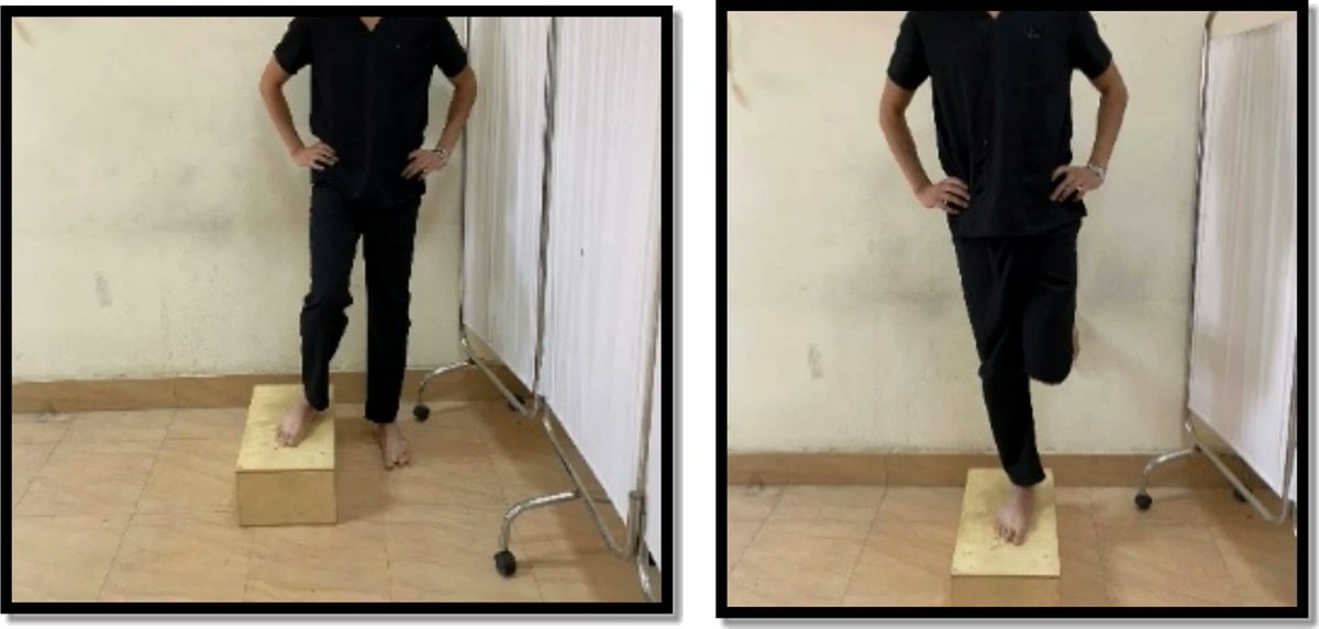 PhysioMeScience's tweet image. Efficacy of adding manual therapy to hip and  knee exercises in patients with patellofemoral pain syndrome: a  double-blinded randomized controlled clinical trial

&quot;non-significant differences between groups in all dependent variables&quot;

👇👇👇

pubmed.ncbi.nlm.nih.gov/40987761/