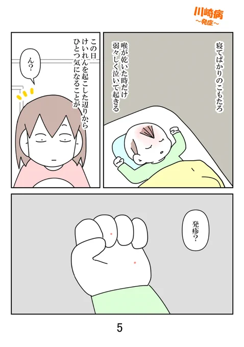 突発性発疹だと思ったら違う!?
知ってほしい、川崎病
発症編 2/3 