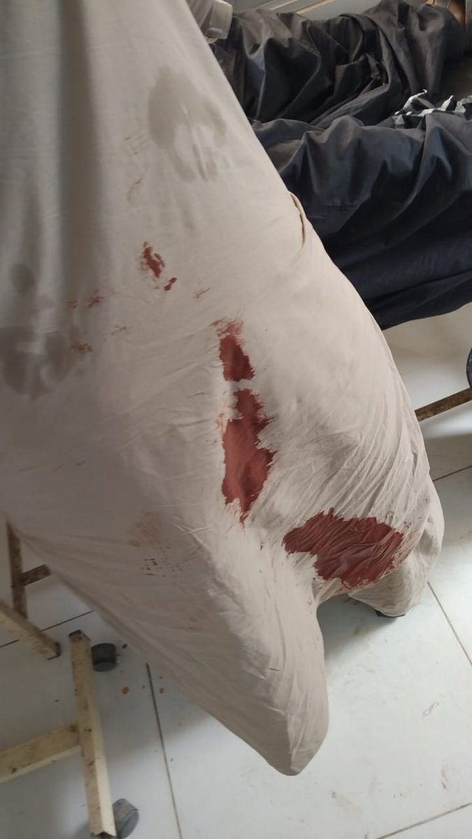 rahman_murad8's tweet photo. A student has been injured by bullets fired by security forces. Universities are meant for knowledge &amp; progress, yet we are facing bullets and crackdowns. This violence against students is unacceptable and condemnable.
#SaveBalochStudents
#StopHarrasingBalochStudents https://t.co/CkdOnK67Uj