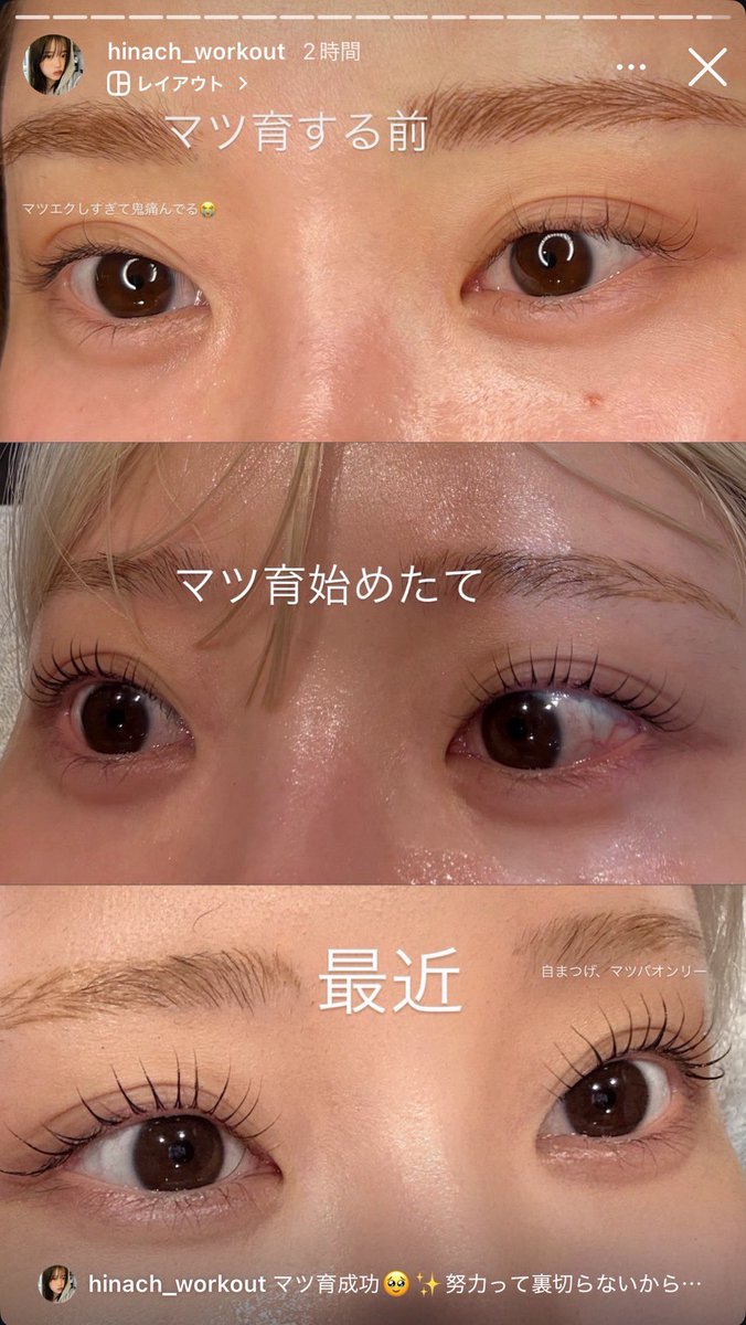 temitayosojobi1's tweet photo. やっぱ、マツエクしすぎると自まつげご愁傷様するからまつ育大事よね。
私はコスノリでギュインギュインに伸ばしたwww https://t.co/TXa9uhbHkn