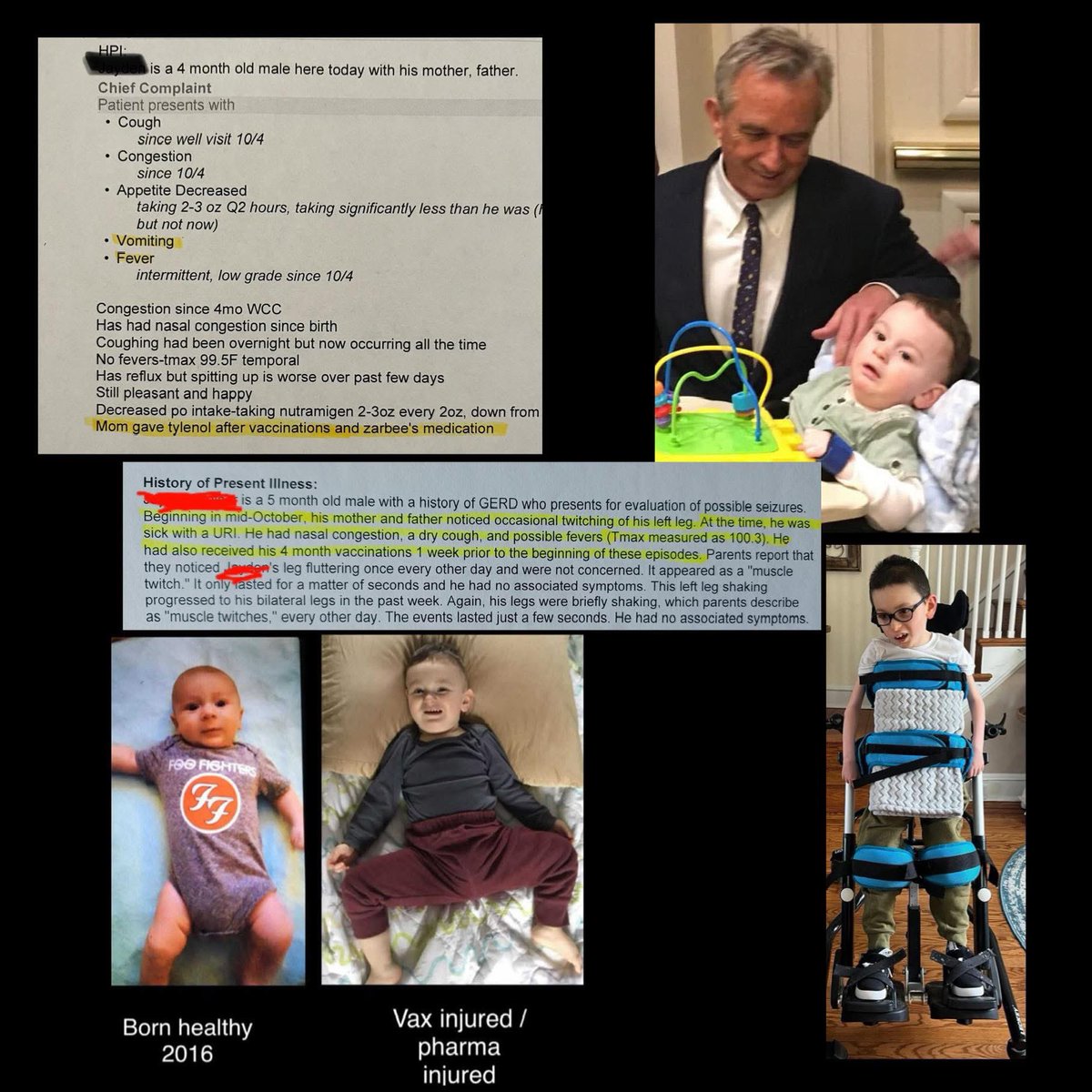 toobaffled's tweet photo. “I watched my perfectly healthy baby, born in the summer of 2016, slip away right in front of my eyes. He was sick from the time he had 2 month vax and it didnt stop until i stopped vax after 4 months…but the neurological damage was already done. The leg jerking in the left leg where he had dtap vax got worse and turned into full blown seizures after 4 months shots. He does NOT have genetic seizures. We’ve done every possible genetic testing over the last 9 years over and over again up to this year.
There is a fire burning inside of me and my voice is going to get much louder!!!
It’s time. 
I’ll be sharing more pieces of his medical records too. You think you have seen corruption…just wait.
I’ll drop my other platforms below. They will not silence me. I will keep fighting. 👊🏼

You have my permission to tag and share!”

Ephesians 6:10-18 ✝️⚔️🛡️🔥”

- Michelle Marie -

IG  - https://t.co/1g3QUjf4tz

TT - https://t.co/ODCpgZB7Dh

YT - https://t.co/saqFhpJzUA