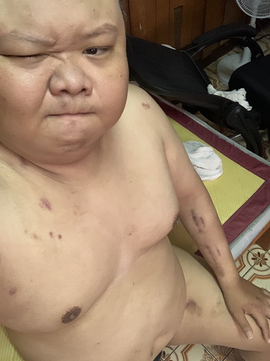 腰受傷還是要認真運動….
好濕…