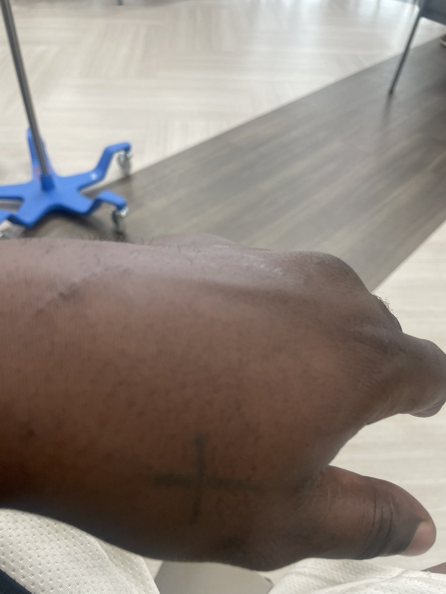 TheeOnlyMACC's tweet photo. Fracture 😭 https://t.co/QB0cXiOlZb