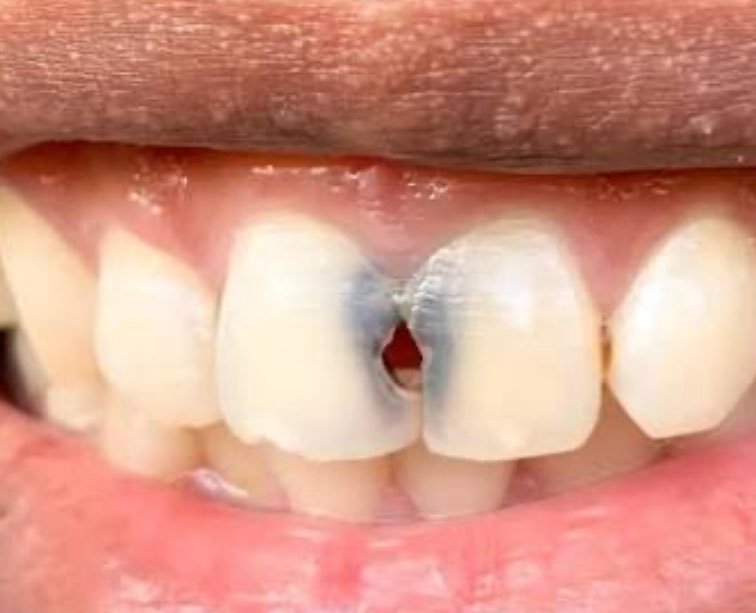 aku koas gigi yang mau dirawat boleh dm tweet media