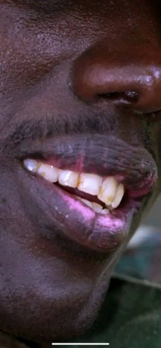 Qui est MAKENGA ?
Makenga est un tutsi Rwandais formé au Rwanda dans le FPR de kagame. Makenga,un analphabète,est né en 1973 des parents refugiés tutsi Rwandais de la vague de 1963. La famille biologique de Makenga habite au Rwanda. Makenga a été brassé dans les FARDC par Ruberwa