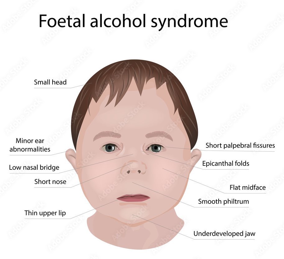 mo (@flexorcist00) on Twitter photo 