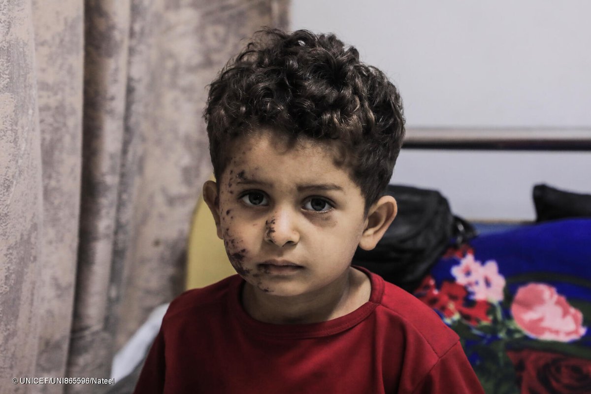 Nour, 10, and Yehya, 3, were badly injured when their shelter in Gaza City was bombed.

Their brother, Moaz, 14, was killed.

UNICEF is providing supplies and services for healthcare and child protection and well-being as much as possible.

But children need a ceasefire NOW.
