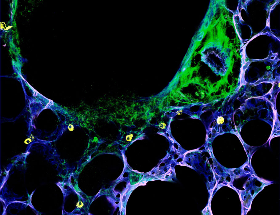 SciImmunology's tweet image. The chitinase-like proteins Ym1 and Ym2 drive #allergen-induced #ExtracellularMatrix remodeling and airway thickening in mice, independent of IL-13 or IL-17A. 

Learn more in Science #Immunology: scim.ag/4ny7Hvu