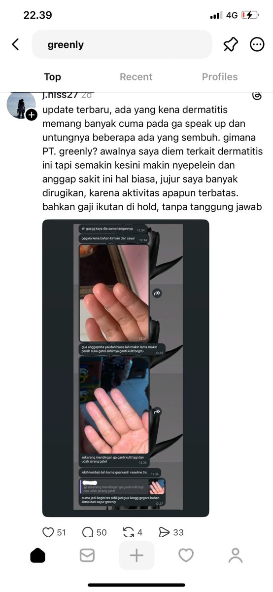 Xpro_310's tweet photo. Masalah seperti Gaji karyawan yang dipotong dengan alasan yang tidak jelas dan juga cara perusahaan manage dan memperlakukan karyawan dengan buruk seperti tidak bertanggung jawab dengan karyawan2 yang terkena “DERMATIS” dan juga suara para karyawan yang dianggap sepeleh https://t.co/1QhE1wQLUO