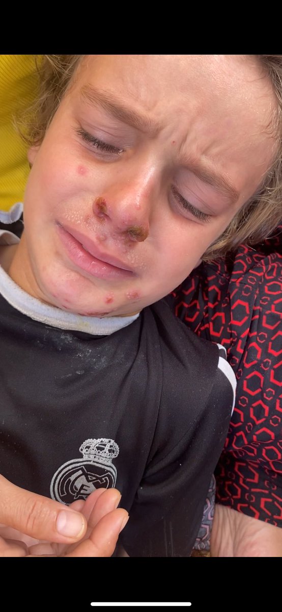 yousef_hosam7's tweet image. 🚨link in bio ☝️🙏
💢The situation has become very worse😔
There is no food and no treatment. My brother mohamed very sick and he need proper lunch. Please help him 🙏