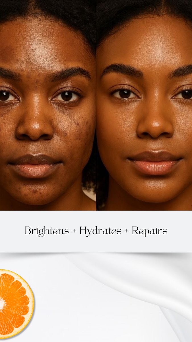 RB Organics 🍀 (PBD/0015) tweet media