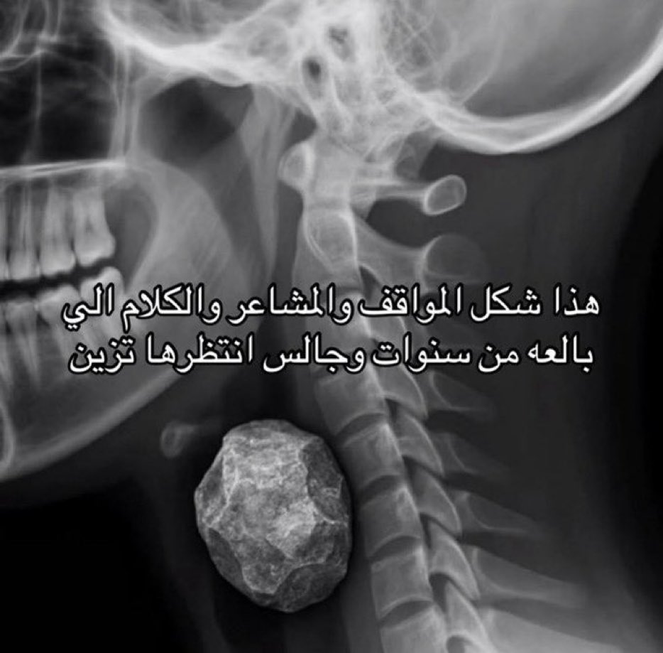 كل يوم صورة معبرة (@memesoficiial) on Twitter photo 