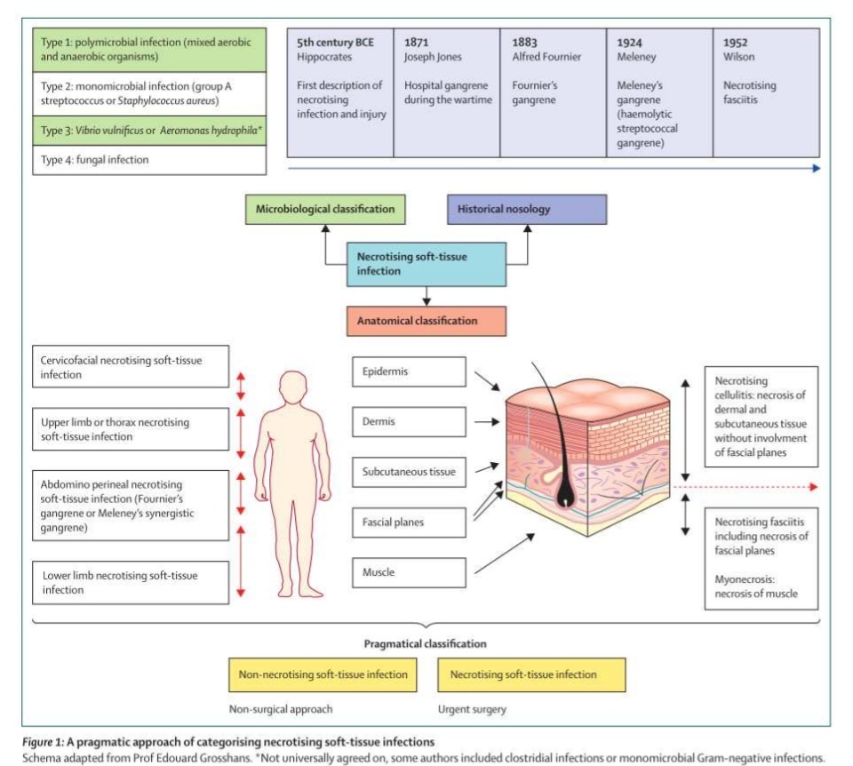 Infecciones Necrosantes de Tejidos Blandos 🦠☠️

🔰📚The Lancet 2023

doi.org/10.1016/51473-…

Enlace a Artículo Completo 👇🏻🆓✅t.me/SoMELaguna
