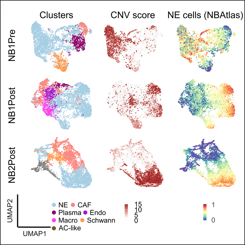 pathsoc's tweet image. Latest Editor’s Choice! #TheJournalOfPathology:

&apos;Spatial transcriptomics exploration of the primary neuroblastoma microenvironment in archived FFPE samples unveils novel paracrine interactions&apos;

…thsocjournals.onlinelibrary.wiley.com/doi/10.1002/pa…

#Neuroblastoma #SpatialTranscriptomics #Pathology #PathSoc