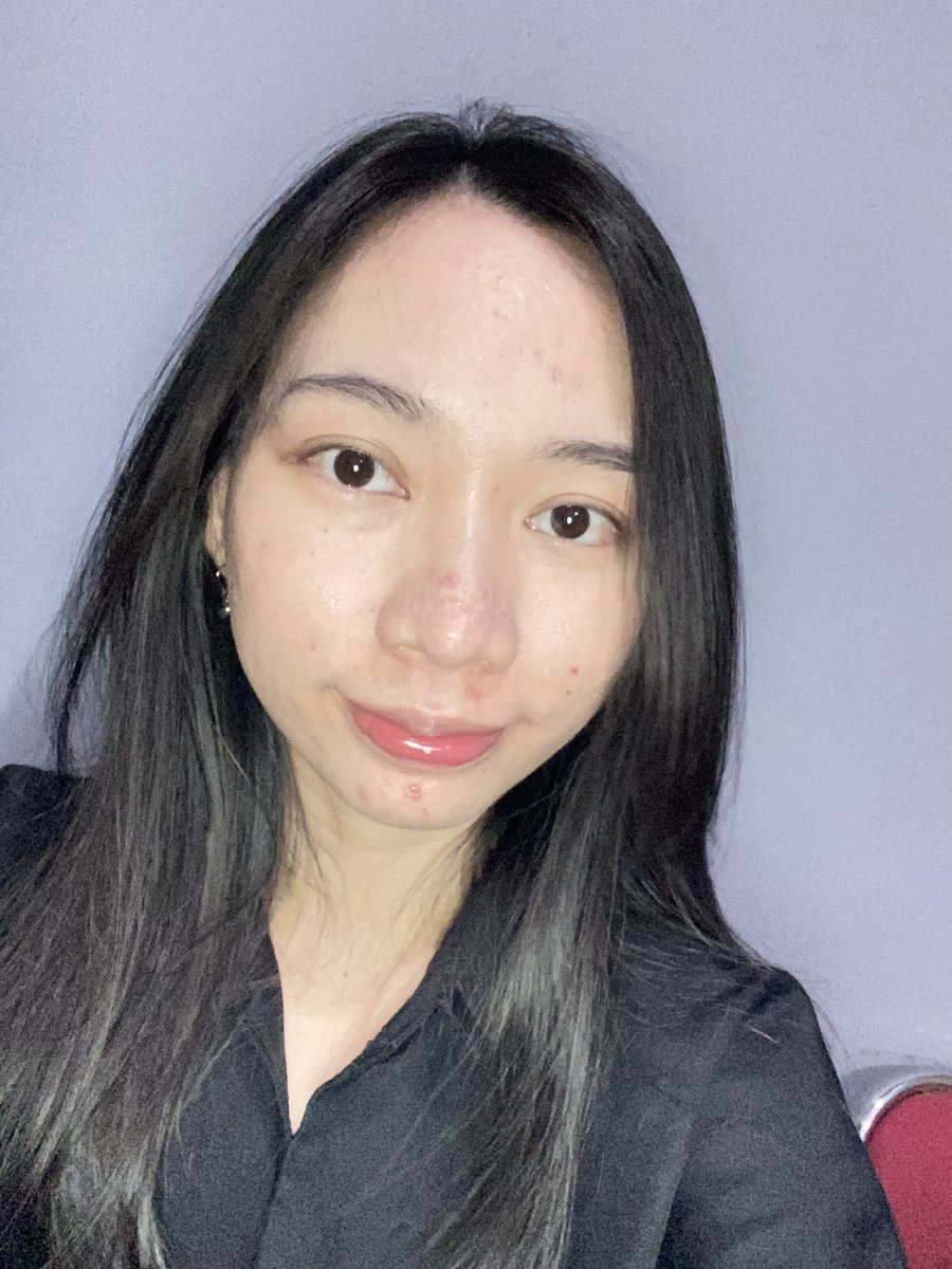 kulit oily &amp; acne prone tuh emg paling aman pake moisturizer tipe gel 🤍

kayak Clinelle Purifying Gel Moistuzer ini nih, teksturnya ringan, gampang menyerap, dan ada kandungan 8x Anti-Blemish &amp; Acne Control Actions ✨