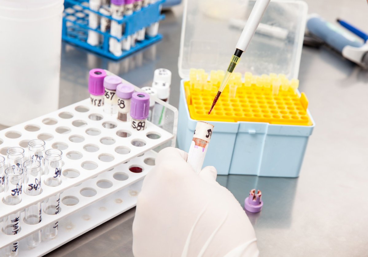 AZoSensors's tweet image. A new #biosensor lets scientists monitor antibody secretion in real time. The study&apos;s authors say it is poised to revolutionize biomanufacturing and drive down production costs. azosensors.com/news.aspx?news… #AzoSensors #Antibodies