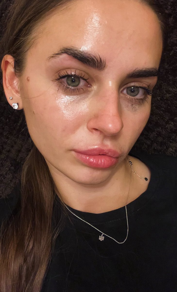 лишила в інсті то і напишу тут 

знайте, що і такий розбитий стан буває 
бо збір – то шалена відповідальність, котра тисне на тебе
бо хочеться допомогти в певний термін, щоб не підставляти і не відтерміновувати чергу інших зборів, де хлопці так само чекають на допомогу
бо боїшся,