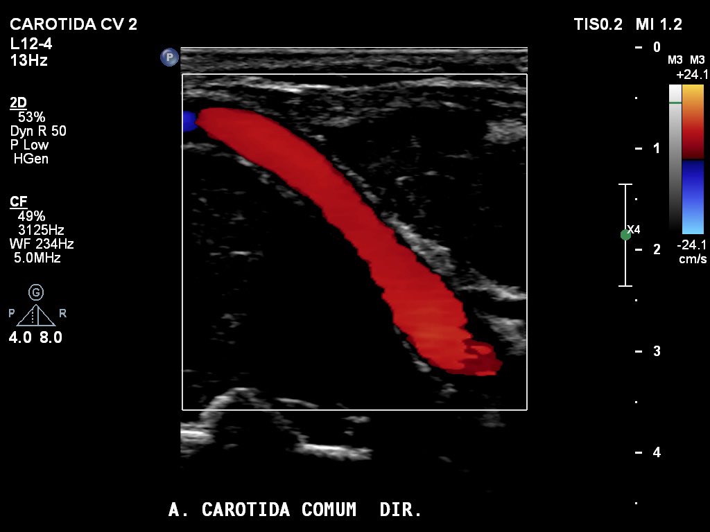 Marcos A. P. Borges, MD 🇧🇷 tweet media
