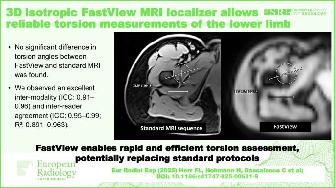 CT and MRI are commonly used to assess femoral and tibial torsion. While CT offers high spatial resolution, it involves ionizing radiation. MRI avoids radiations but requires multiple sequences and extended acquisition time. The authors retrospectively evaluated whether a 3D