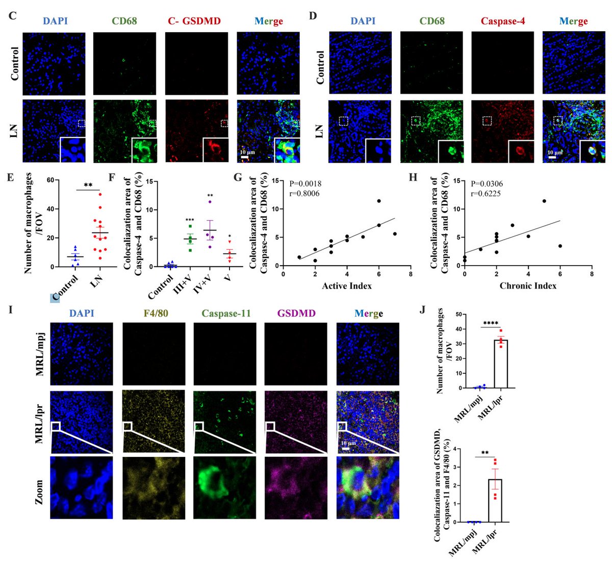 ACR_Journals's tweet photo. Investigation in lupus nephritis patients and MRL/lpr mice demonstrated caspase-4/5/11-mediated pyroptosis pathway is activated in macrophages of lupus nephritis kidneys and contributes to pathogenesis of LN

Arthritis &amp; Rheumatology
https://t.co/84hER2aH15 https://t.co/EQwu65Oeoe