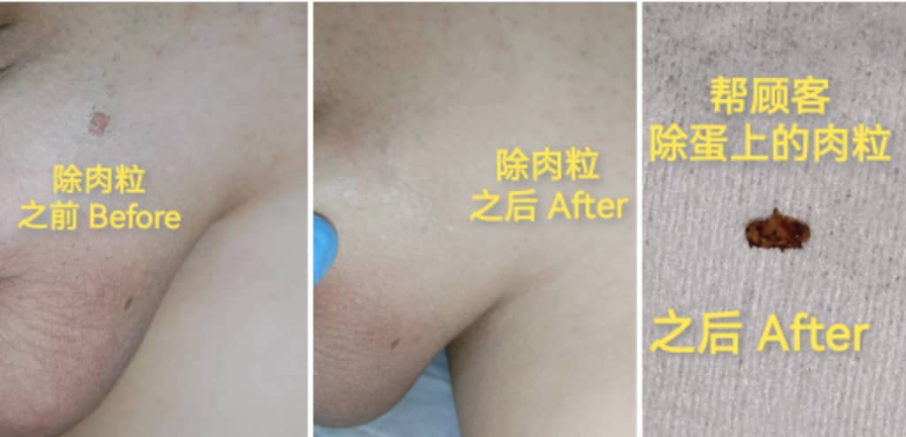 00后采耳冰点除毛师的（备用号） tweet media