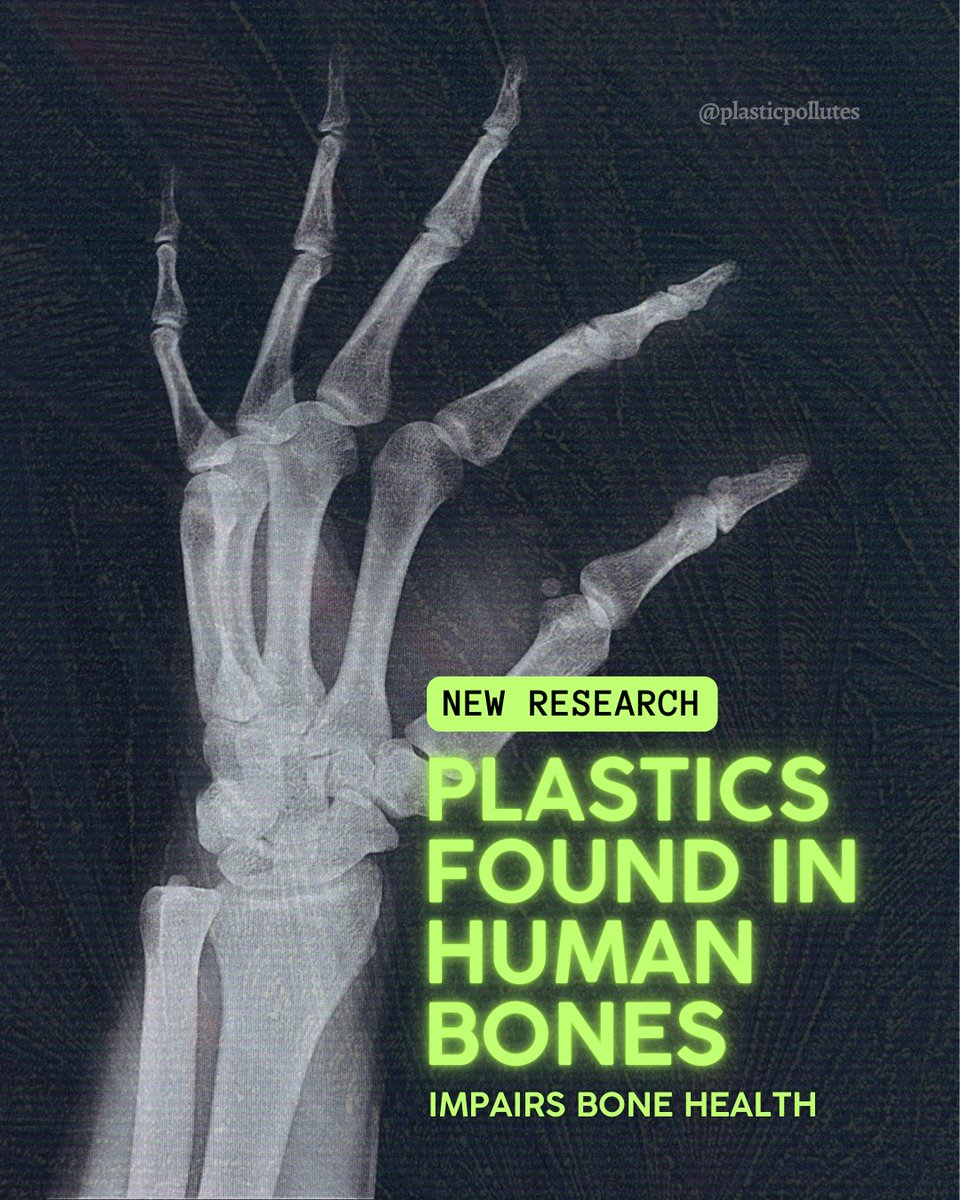 In a new scientific review, researchers examined 62 studies in order to determine the known effects of microplastics on human and animal bones.  They found that micro and nanoplastics could be harming bone health in various ways, including:⁠
⁠
🦴 Impairing bone marrow stem cell