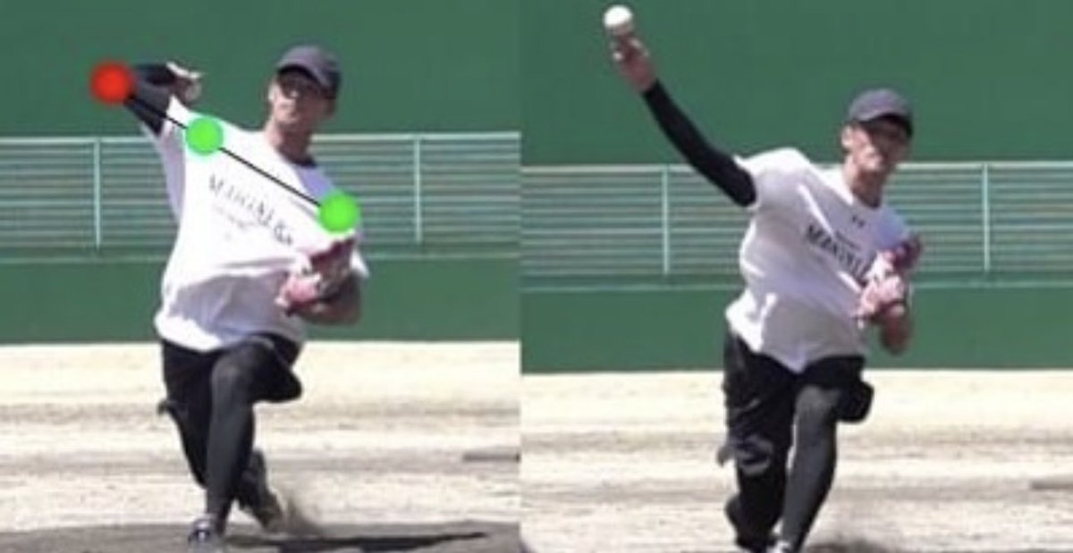 ✅　野球肩・肘をなくそう！！

肩が痛い。

肘が痛い選手は多くいます。

球数制限・連投の禁止などいろいろ取り組みがされています。

現実的にはこの3連休、結構な球数投げている選手は多いはず。