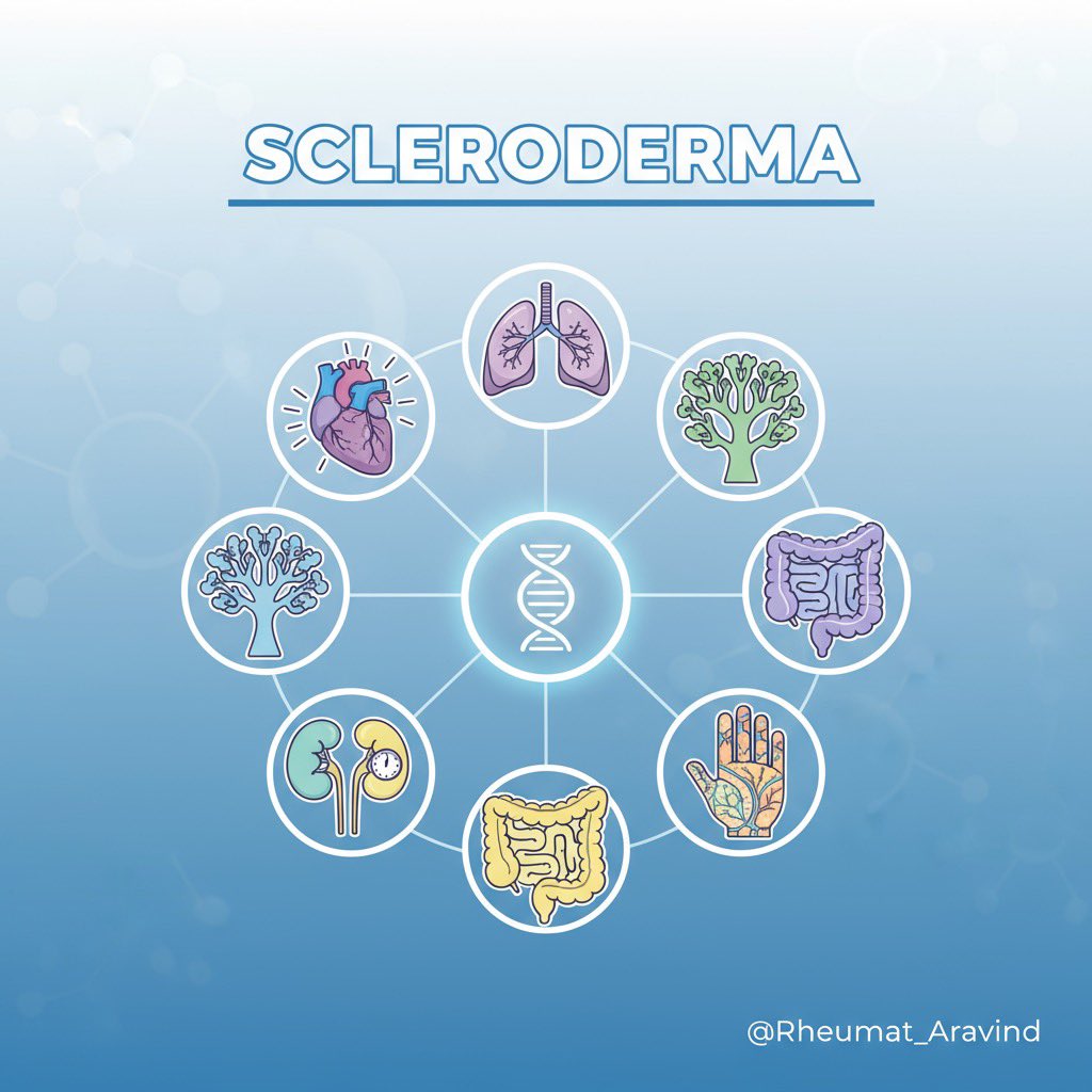 🧵 Management of Scleroderma (Systemic Sclerosis) – 2025 Update

1/
Scleroderma (Systemic Sclerosis, SSc) is a chronic autoimmune connective tissue disease with fibrosis, vasculopathy, and autoimmunity at its core.
Management is organ-specific and evolving with new evidence.