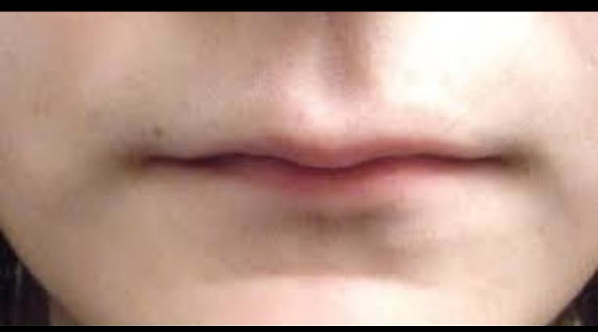 Bağıran kadının dudak fenotipi. Asla şaşırtmaz.
