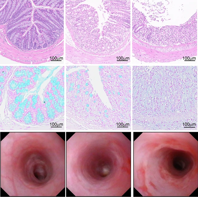 Intestinal_Cell's tweet image. Researchers show that GPR15 differentially regulates the effects of cigarette smoke exposure on Crohn’s disease and ulcerative colitis. 🚬
🔓 Full details in @sigtrans_sttt: go.nature.com/3VWdEXd