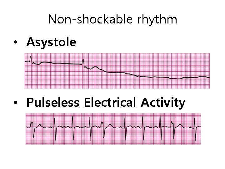 How often should adrenaline be administered during cardiac arrest with PEA or asystole?
A. Every 1 minute
B. Every 2 minutes
C. Immediately, then every 3–5 minutes
D. Only once