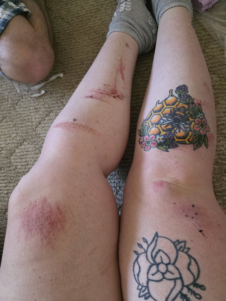 BubatzBea's tweet photo. Guess who can now accurately say when it feels like they've been hit by a car?

You think you can stop me? So did that car. I am so glad to be alive but I really do not recommend this experience to anyone. Be safe out there https://t.co/SXdvp0J9Gz