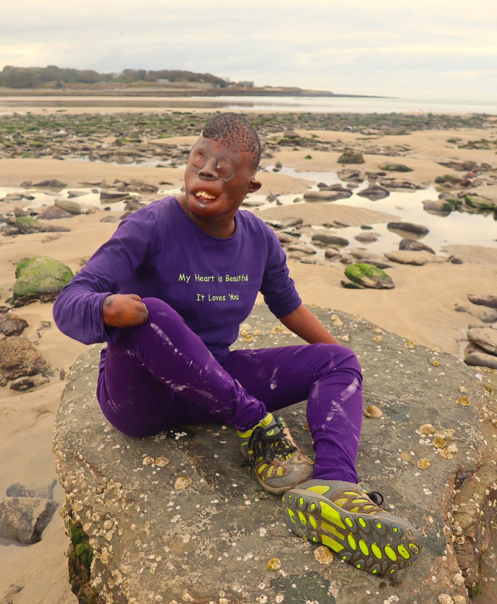 ChildrenOfFire's tweet photo. #purpleheart #Dorah #ColorPurple #burns survivor #Scotland the #FarNorth. My heart is beautiful, It loves you https://t.co/1MIBIyp67h