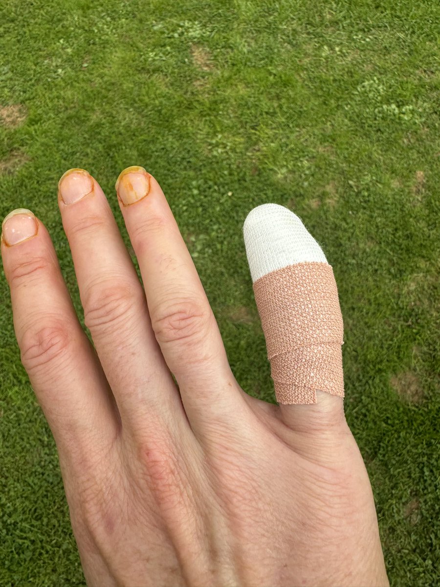 Mum spent the day at plastic trauma unit and is out of action for 2 weeks ! Means we have her to ourselves 🥰she’s kinda happy about that too ☺️💙🐾