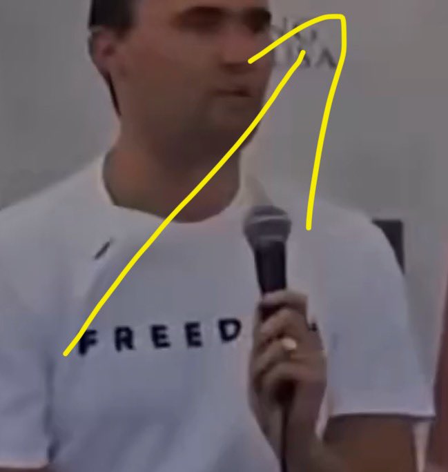 l8stmanstanding's tweet image. There is no traditional gun shot! The magic “bullet” comes from the mic underneath his shirt and enters below his shirt collar and what you see is the exit.