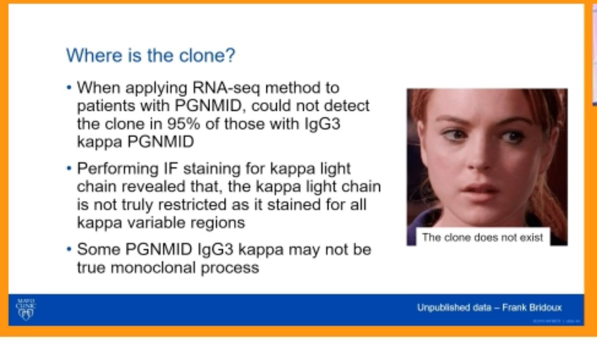Dr Fernando Fervenza on Management of Monoclonal gammopathy of renal significance 

Why is it so hard to detect clone in PGNMID? Does a clone really exist here? Interesting discussion <a href="/GlomCon/">GlomCon</a>  #GlomConHawaii