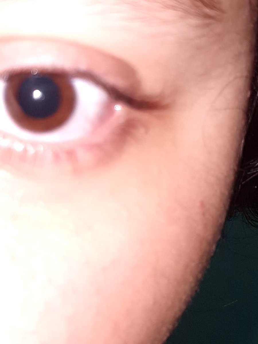 Alvvv
#drugtwt