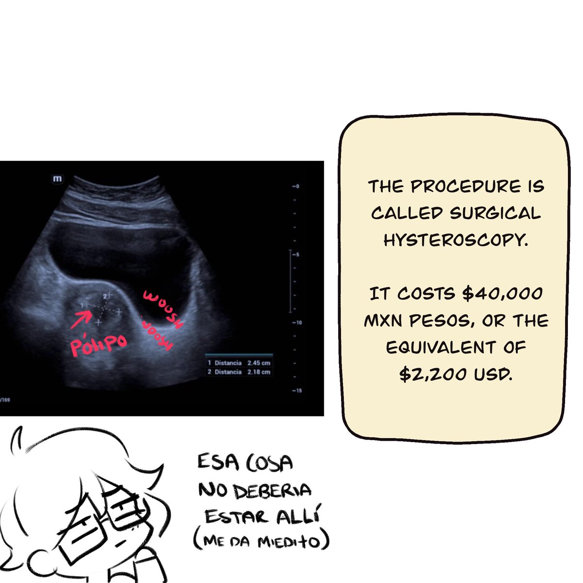 ‼️ Hello everyone, I hope everyone is well. I'm so ashamed to find myself in this situation, but I really need your help. I need surgery, which I can't afford.

In this thread I explain my situation and how you can support me. I will be very grateful for any form of support.