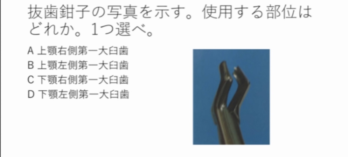 119回歯科医師国家試験対策 ロムニーハウス勉強会【講師 Dr.N