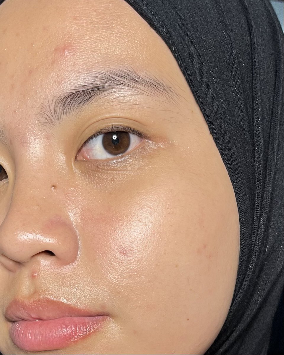 Dryskin, kulit gradakan ku pake Advanced Snail 96 Mucin Power Essence dari COSRX✨ buatku, ini penyelamatt BANGEET💗