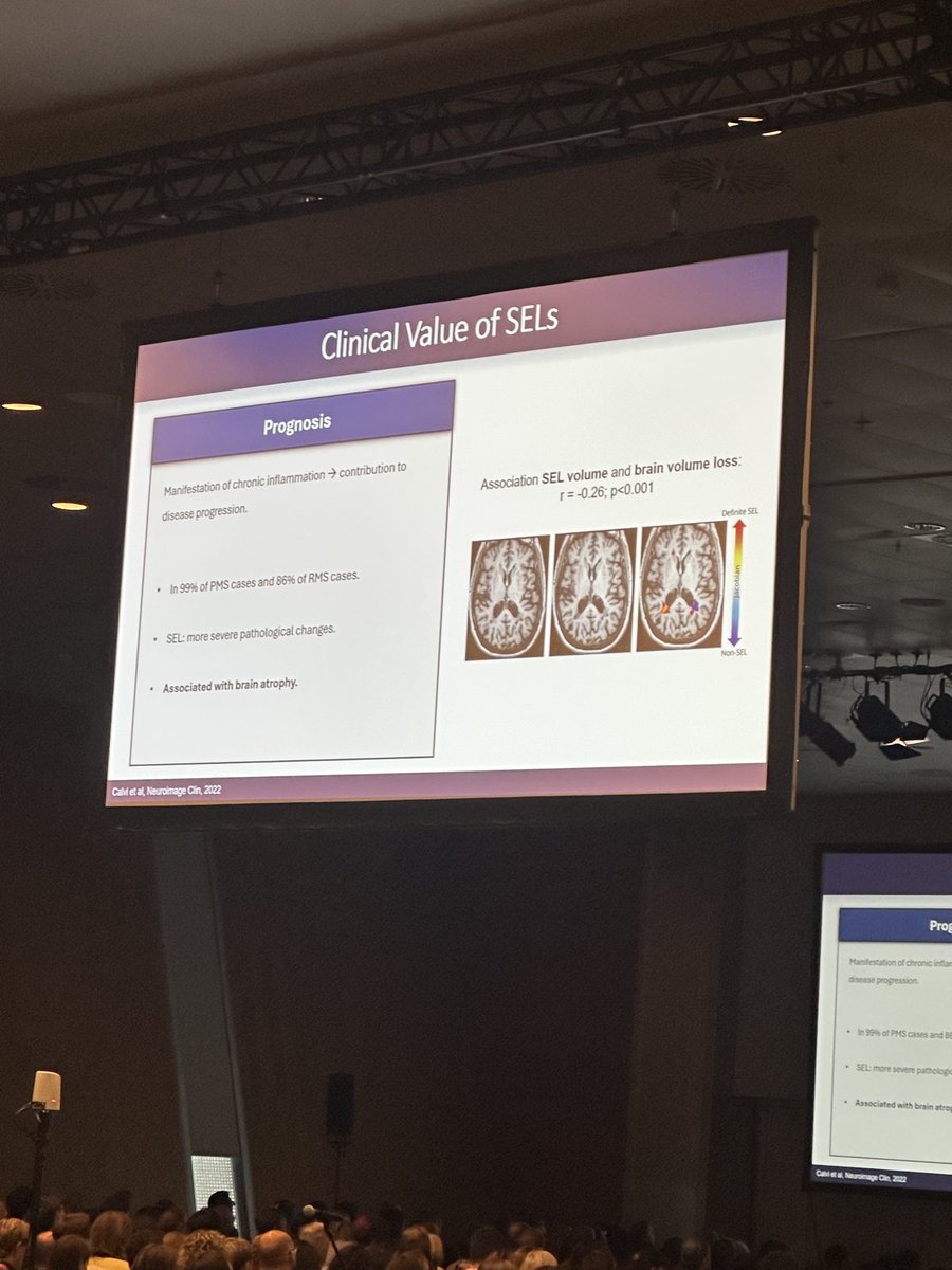 SEL’s slowly expanding lesions can predict progression over time and can be detected on conventional MRI #ectrims2025