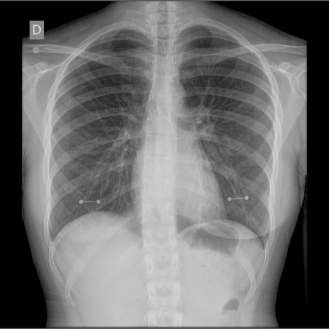aheppendimento's tweet photo. @HIL_TONabad fui ao médico verificar uma tosse que tava durando semanas 💔 https://t.co/fmKlpUuOC2