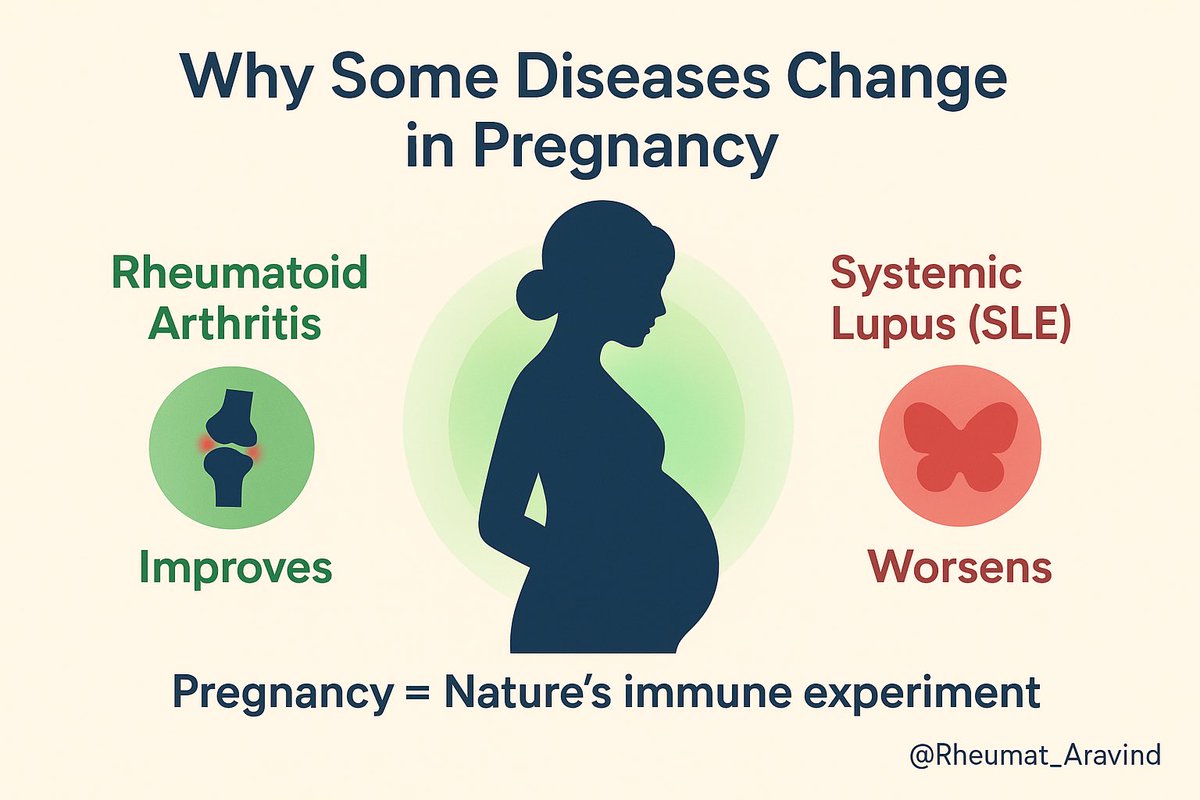 Aravind Palraj (@rheumat_aravind) on Twitter photo 🧵Thread: Why Some Diseases Vanish in Pregnancy?
Tweet 1 (Hook):
Some diseases magically improve in pregnancy (like Rheumatoid Arthritis)…
Others worsen (like Lupus).
It’s one of the strangest puzzles of the immune system.
Here’s the fascinating story 🧵👇
<a href="/DrAkhilX/">Dr. Akhil 🇮🇳</a> 🧵Thread: Why Some Diseases Vanish in Pregnancy?
Tweet 1 (Hook):
Some diseases magically improve in pregnancy (like Rheumatoid Arthritis)…
Others worsen (like Lupus).
It’s one of the strangest puzzles of the immune system.
Here’s the fascinating story 🧵👇
<a href="/DrAkhilX/">Dr. Akhil 🇮🇳</a>
