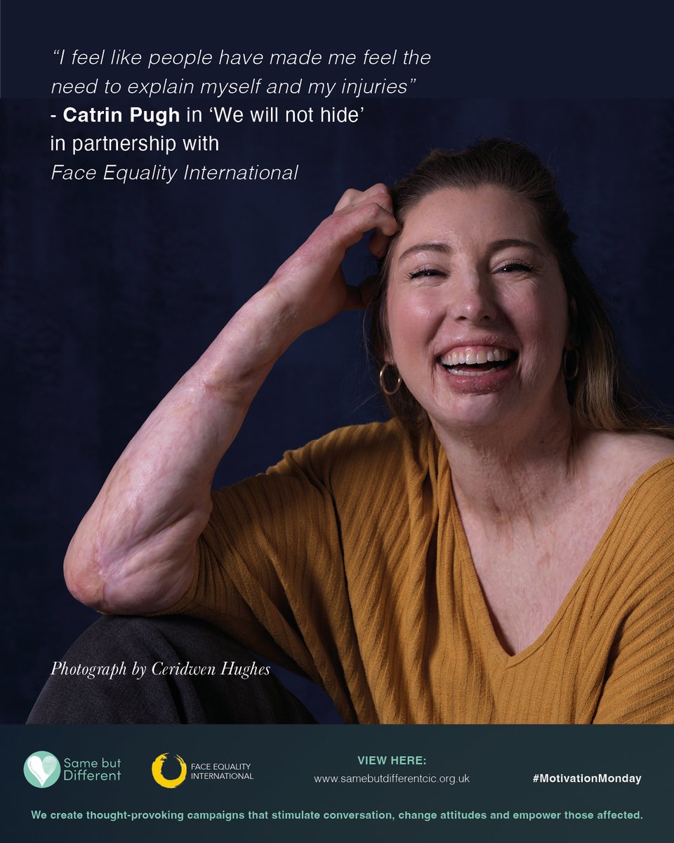 SamebutDifferent tweet media