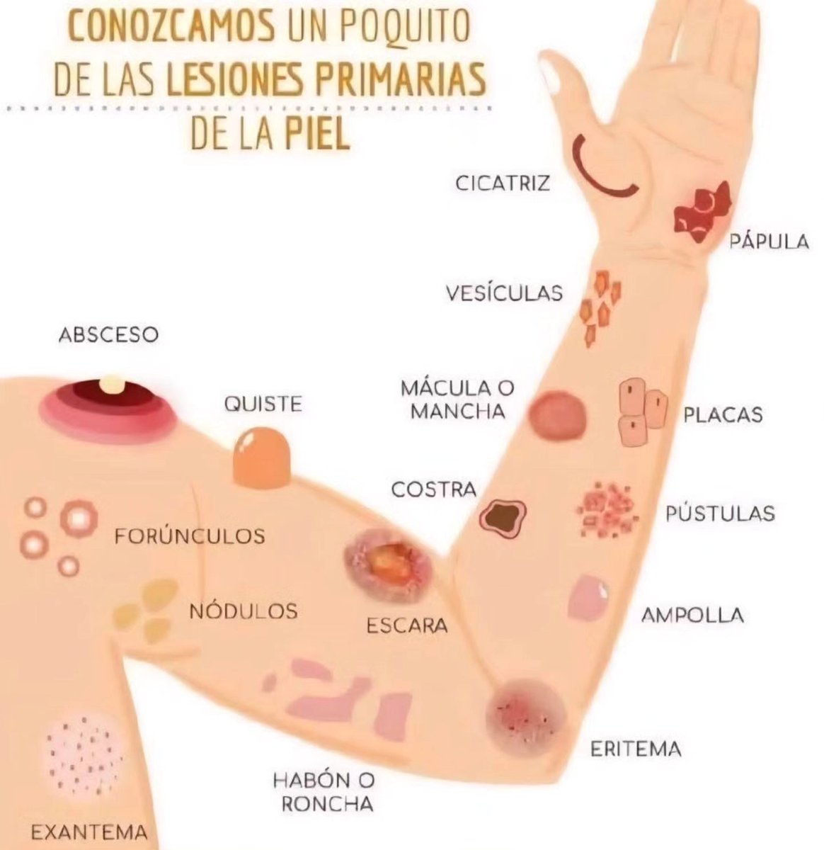 Lesiones primarias que puede sufrir tu piel. 🤓