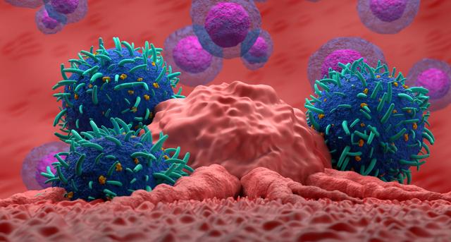 Krebsbelastung steigt weltweit, sinkende Sterberaten in Deutschland: Seattle/Sydney – Weltweit hat sich die Zahl der Krebsneuerkrankungen in den vergangenen 3 Jahrzehnten mehr als verdoppelt. 2023 wurden nach Schätzungen 18,5 Millionen neue Fälle und… dlvr.it/TNHRTS