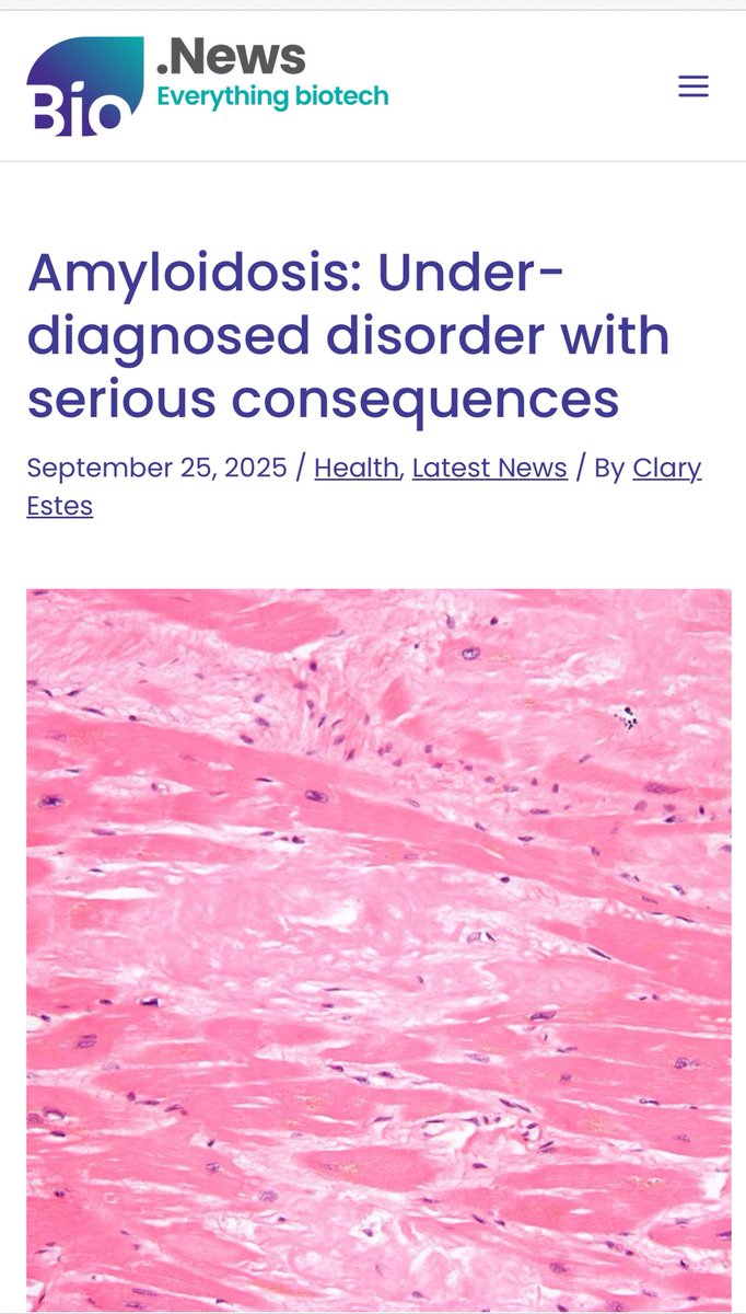 The Amyloidosis Army always working to spread awareness of Amyloidosis wants to thank Clary Estes for working with us on this fantastic article!!

bio.news/health/amyloid…

Working together we can bring Amyloidosis out of the dark!!
Amyloidosisarmy.org