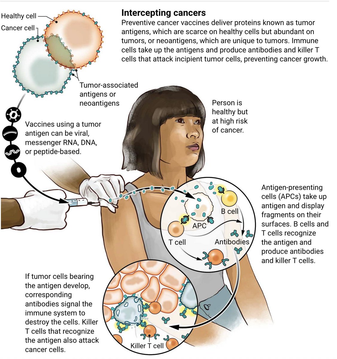 Vaccini di nuova generazione contro il cancro: presentano antigeni tumorali all’organismo, che attiva il sistema immunitario per eliminare le cellule maligne quando si sviluppano. 

Non è fantascienza: la lotta al cancro sta veramente cambiando volto. 

science.org/content/articl…