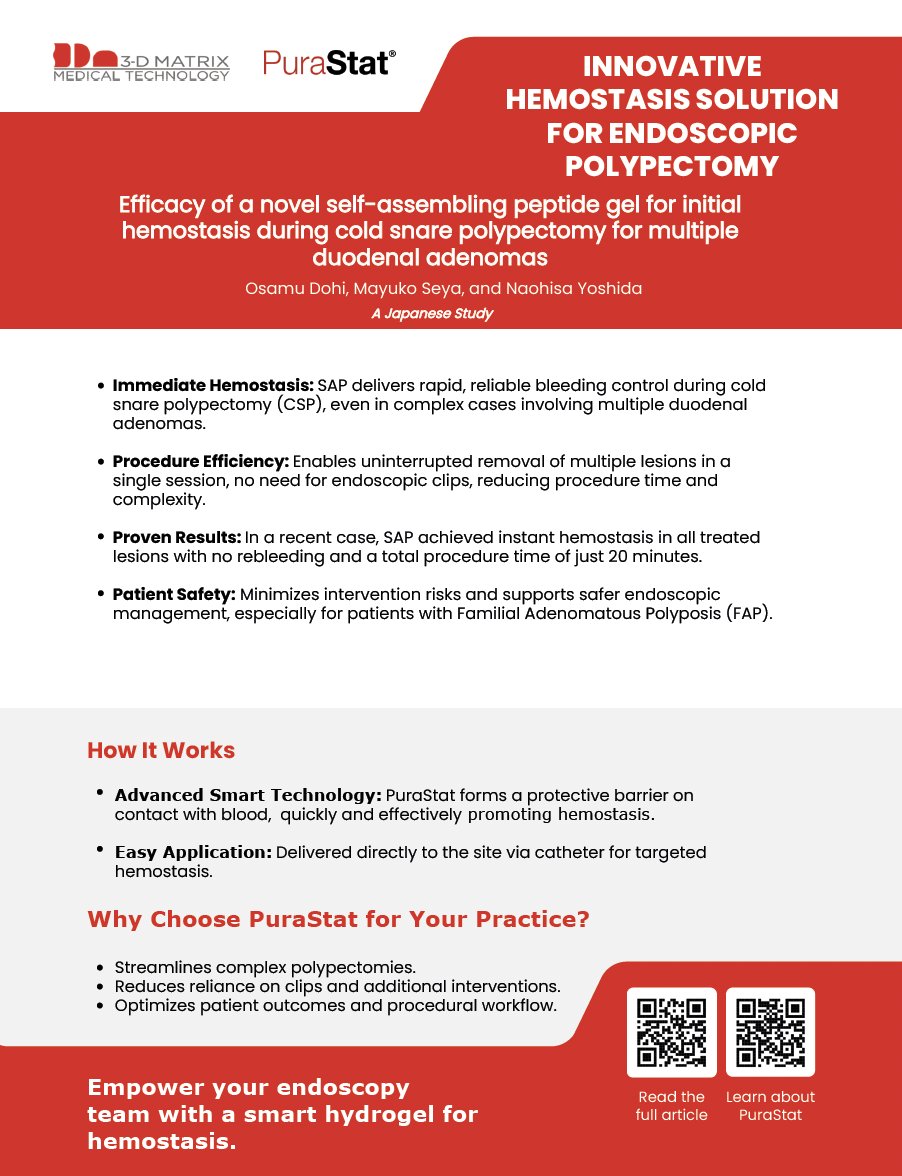 Stats that matter!

-100% hemostasis
-0 rebleeds
- 20 min total procedure (multiple duodenal adenomas, no clips!)

PuraStat makes complex endoscopy safer &amp; faster.

Read the article here: threedmatrix.showpad.com/share/WQrsEEc9…